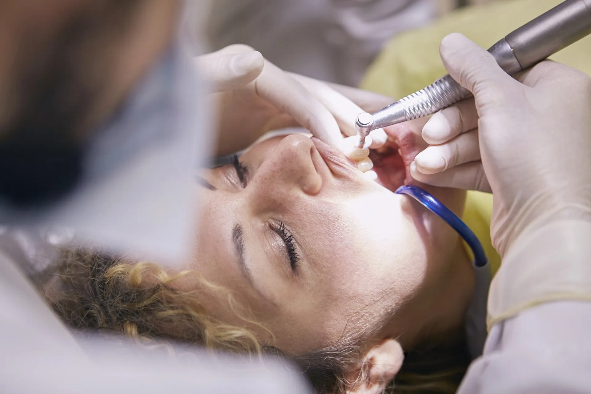 Emergency dental treatment being performed for tooth pain at Great Smiles Buford Center in Buford GA